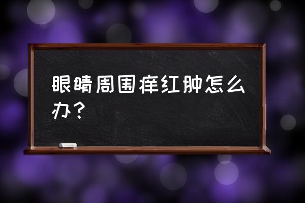 眼睛周围红肿 眼睛周围痒红肿怎么办？