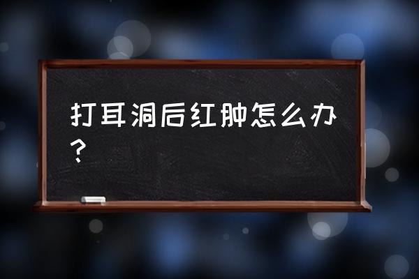 新打的耳洞肿了怎么办 打耳洞后红肿怎么办？