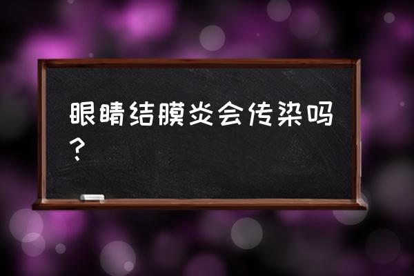 结膜炎传染吗几天能好 眼睛结膜炎会传染吗？