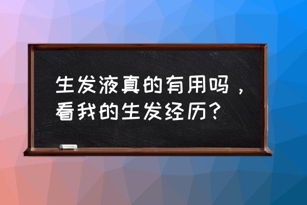 真的有生发产品吗 生发液真的有用吗，看我的生发经历？