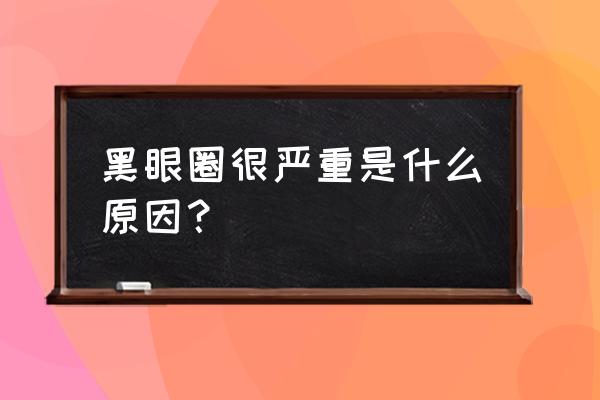 黑眼圈严重什么原因 黑眼圈很严重是什么原因？