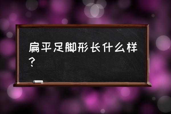 扁平足的脚是什么样的 扁平足脚形长什么样？