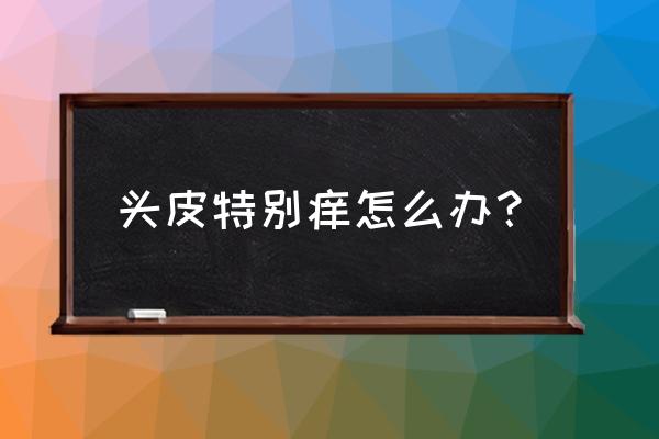 头皮发痒怎么解决 头皮特别痒怎么办？