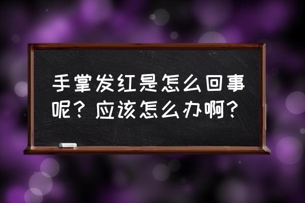 手掌全部发红是怎么了 手掌发红是怎么回事呢？应该怎么办啊？