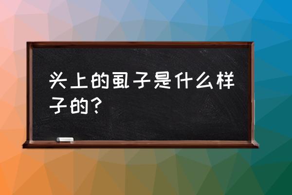 怎么判断头上长虱子 头上的虱子是什么样子的？