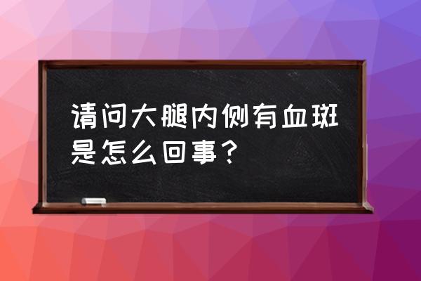 大腿内侧有红斑像淤血 请问大腿内侧有血斑是怎么回事？