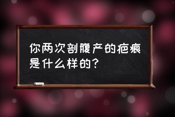 剖腹产的疤痕有多大 你两次剖腹产的疤痕是什么样的？