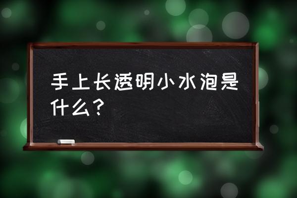 手上起透明水泡 手上长透明小水泡是什么？