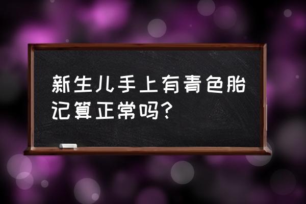 青色胎记的位置与命运 新生儿手上有青色胎记算正常吗？