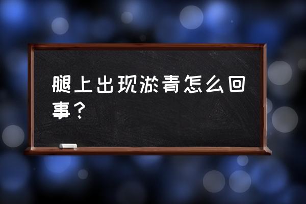 腿上到处都是淤青 腿上出现淤青怎么回事？