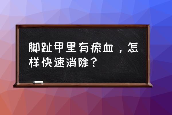 脚趾甲淤血怎么处理 脚趾甲里有瘀血，怎样快速消除？