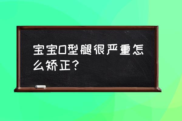 重度o型腿怎么办 宝宝O型腿很严重怎么矫正？