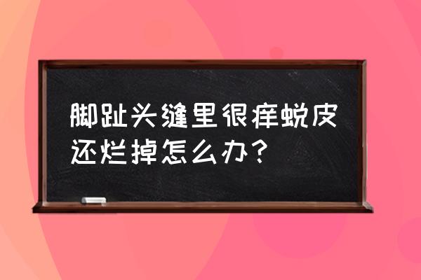 脚趾缝里面烂了怎么办 脚趾头缝里很痒蜕皮还烂掉怎么办？