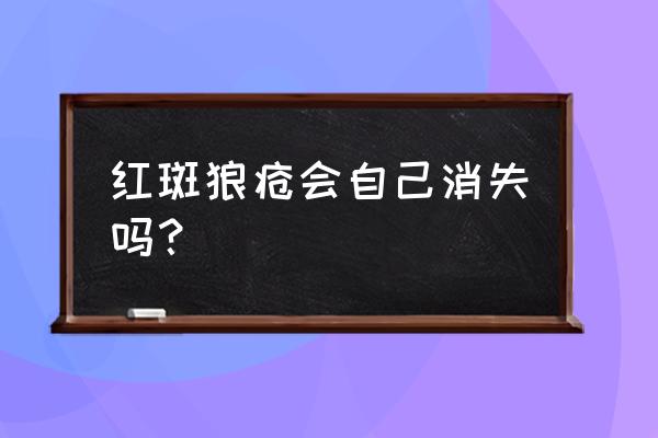 盘状红斑狼疮会自愈吗 红斑狼疮会自己消失吗？