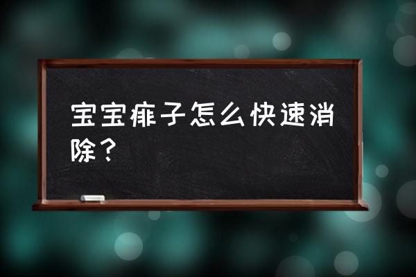 宝宝长痱子怎么好的快 宝宝痱子怎么快速消除？