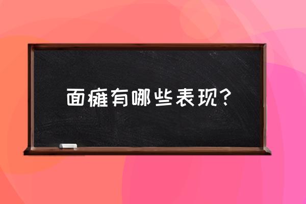 什么是面瘫表现 面瘫有哪些表现？