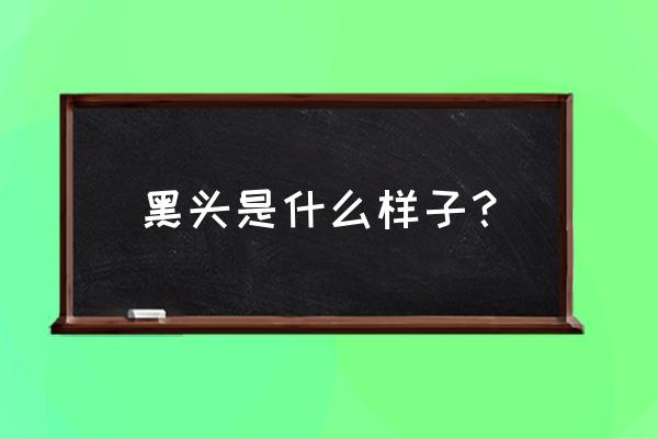 鼻子上的黑头是什么样子 黑头是什么样子？