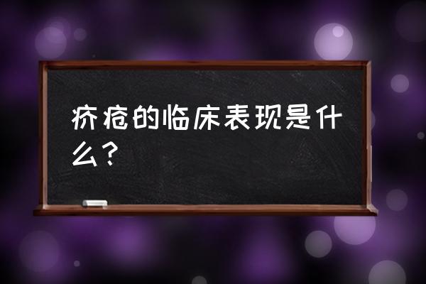 疥疮一般多久可以痊愈 疥疮的临床表现是什么？