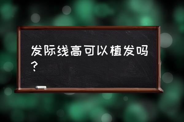 发际线高能植发吗 发际线高可以植发吗？