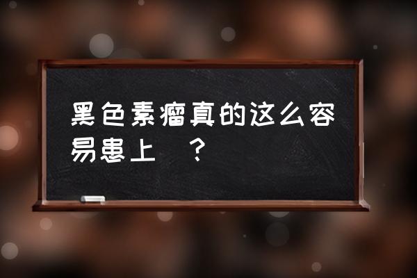 黑色素肿瘤怎么形成的 黑色素瘤真的这么容易患上嗎？