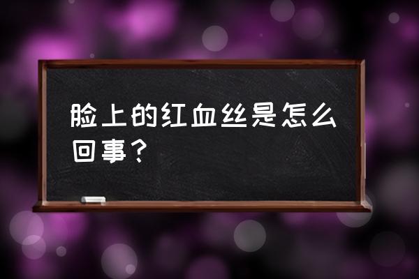 脸红血丝什么样 脸上的红血丝是怎么回事？