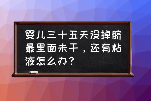 新生婴儿肚脐20天没掉怎么办 婴儿三十五天没掉脐最里面未干，还有粘液怎么办？