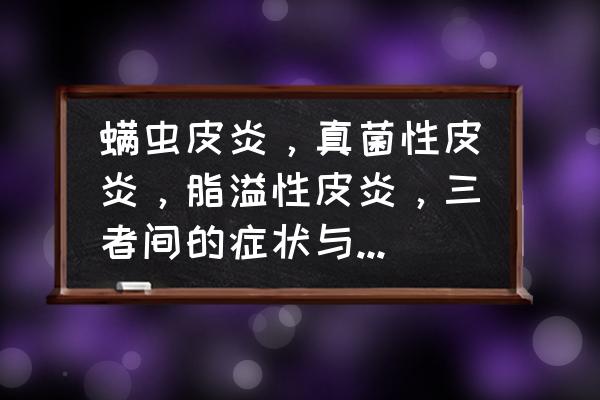 面部皮炎的10种症状图 螨虫皮炎，真菌性皮炎，脂溢性皮炎，三者间的症状与区别是什么？