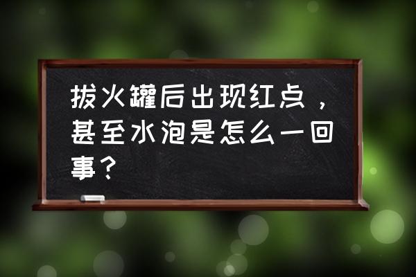 拔罐拔出水泡是怎么回事 拔火罐后出现红点，甚至水泡是怎么一回事？